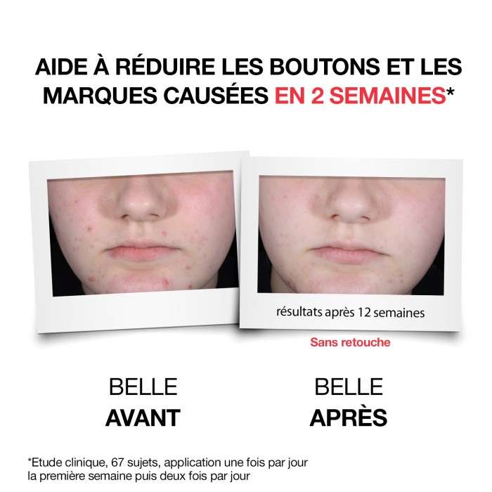 NEUTROGENA ANTI BOUTONS+ SERUM QUOTIDIEN 30ML