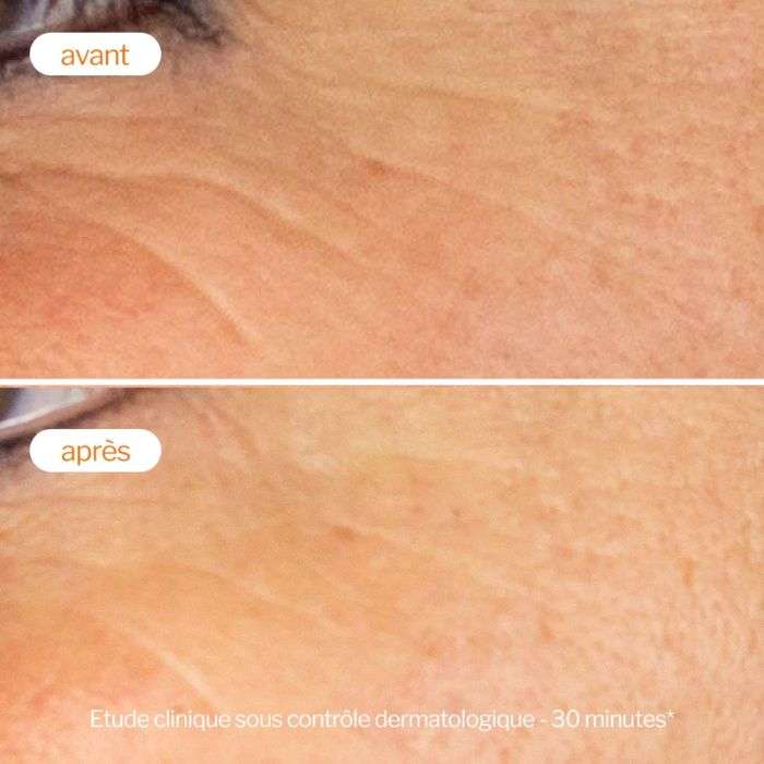 NOVEXPERT COFFRET VITAMINE C ROUTINE ECLAT ANTI AGE + CONTOUR YEUX 15ML