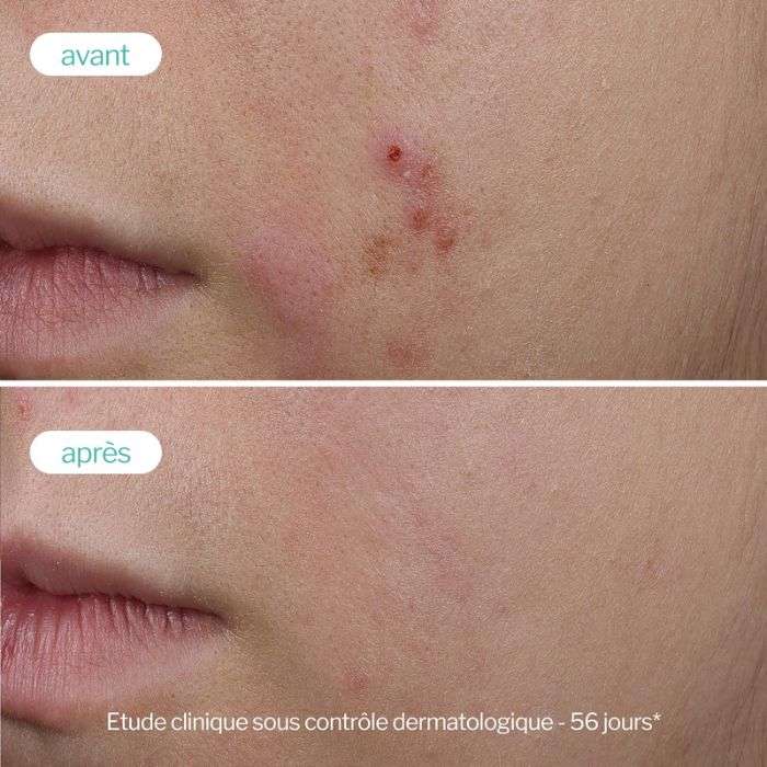 NOVEXPERT SERUM BOOSTER TRIO ZINC ANTI IMPERFECTIONS ANTI AGE 30 ML