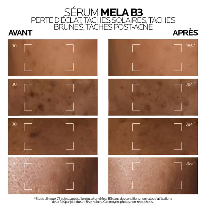 LA ROCHE POSAY OFFRE BLACK FRIDAY ROUTINE ANTI TACHES MELA B3 GEL MICRO PEELING ANTI TACHES 200 ML ET MELA B3 SERUM + TROUSSE ET