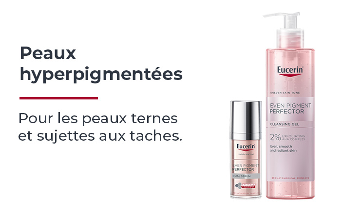 peau hyperpigmentée